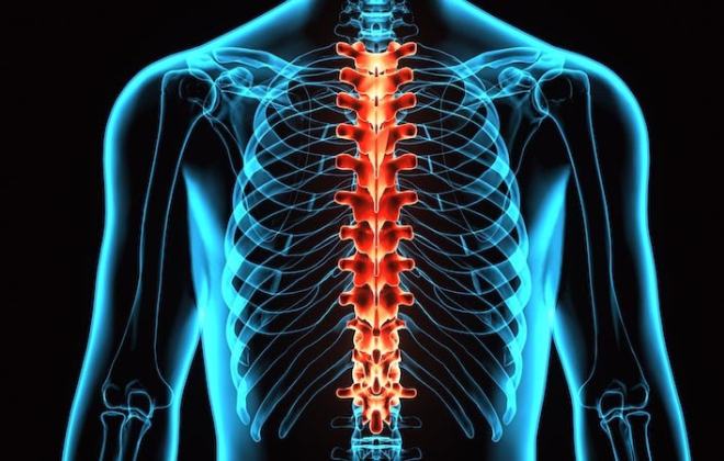 Spinal Cord Injury Claim